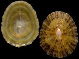 Patella vulgata