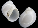 Polinices lacteus